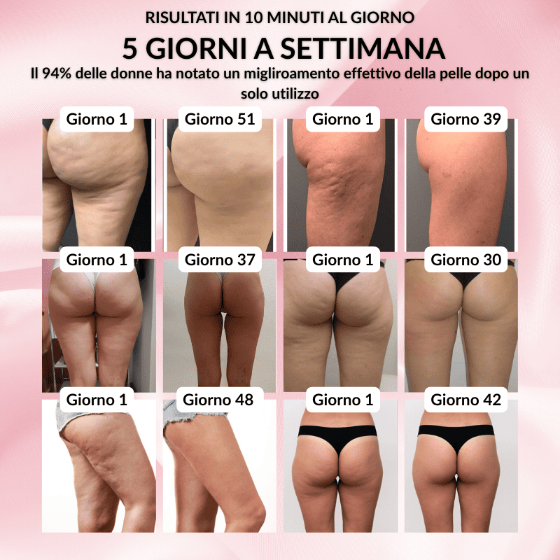 HealthyCellulite