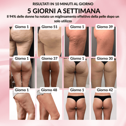 HealthyCellulite